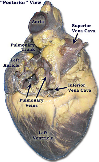 Pig Heart Diagram Labeled : Biological Science Picture ...