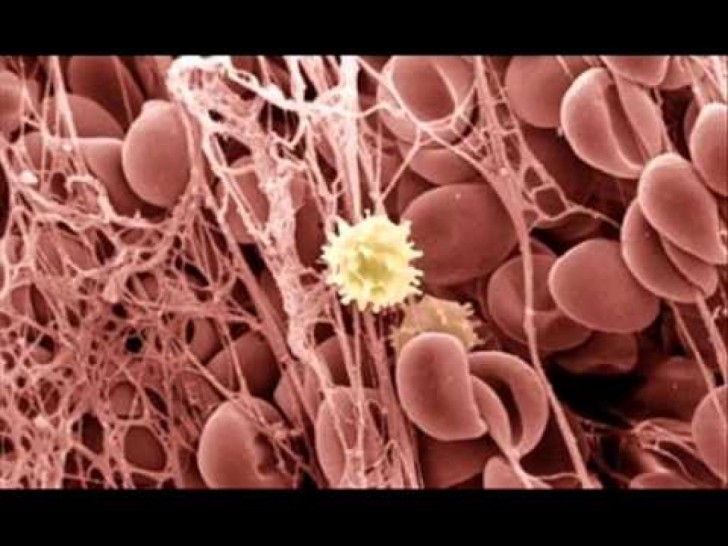 White Blood Cells In Urine : Biological Science Picture Directory