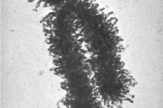 Human Chromosome Photo , 5 Human Chromosome Structure In Cell Category