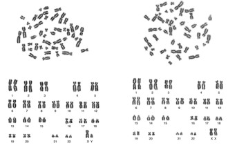 Human Chromosomes Female And Male , 5 Human Chromosome Structure In Cell Category