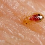 bed bug bite skin , Bed Bug Pictures In Bug Category