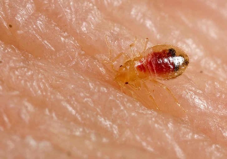 Bug , Bed Bug Pictures : Bed Bug Bite Skin