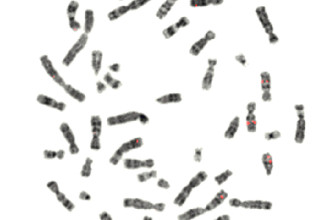 Chromosomes , 5 Animal Cell Chromosomes Images In Cell Category