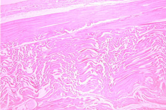 Skeletal Muscle Tissue , 4 Skeletal Muscle Tissue Slide In Muscles Category