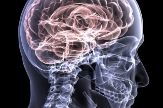 Brain Injury Awareness , 5 Phineas Gage Accident Brain Injury Pictures In Brain Category
