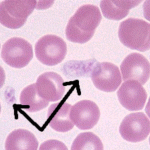 Immune Destruction of Blood Platelets , 8 Platelets Science Photo In Cell Category