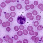 Neutrophil Histology , 8 Neutrophils Pictures In Cell Category