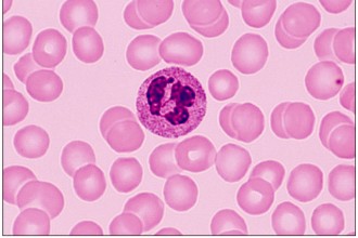 Neutrophils , 8 Neutrophils Pictures In Cell Category