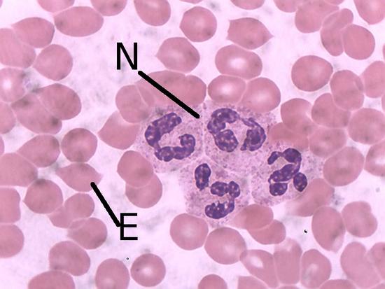 Cell , 8 Neutrophils Pictures : Neutrophils In Human Blood