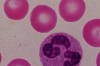 Neutrophils Picture , 8 Neutrophils Pictures In Cell Category