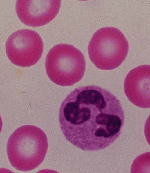 Cell , 8 Neutrophils Pictures : Neutrophils Picture