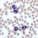 Neutrophils review , 8 Neutrophils Pictures In Cell Category