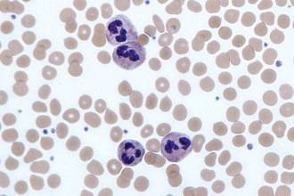Neutrophils Review , 8 Neutrophils Pictures In Cell Category
