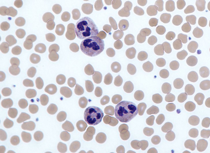 Cell , 8 Neutrophils Pictures : Neutrophils Review