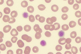 Platelet Function Testing in Ecosystem
