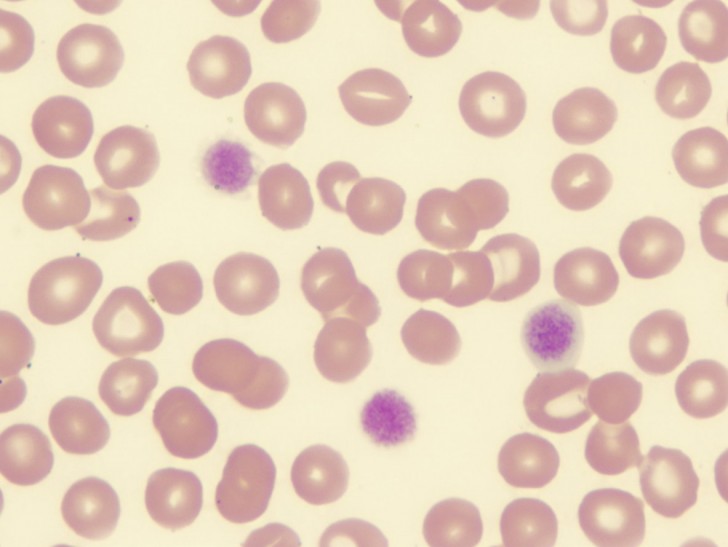 Cell , 8 Platelets Science Photo : Platelet Function Testing