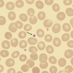 Platelets , 8 Platelets Science Photo In Cell Category