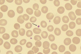 Platelets , 8 Platelets Science Photo In Cell Category