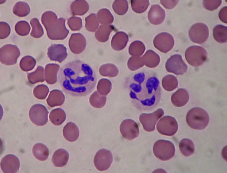 Cell , 8 Neutrophils Pictures : Segmented Neutrophils