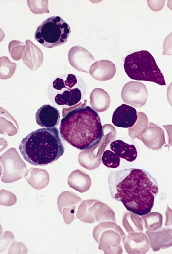 Cell , 8 Neutrophils Pictures : Two Hypogranular Neutrophils