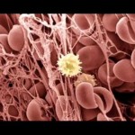 White Blood Cells In Urine , 8 White Blood Cells In Urine Pictures In Cell Category