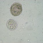 White blood cells at 400x , 8 White Blood Cells In Urine Pictures In Cell Category
