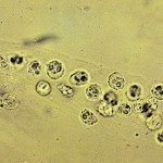 White blood cells casts pictures , 8 White Blood Cells In Urine Pictures In Cell Category