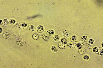 White Blood Cells Casts Pictures , 8 White Blood Cells In Urine Pictures In Cell Category
