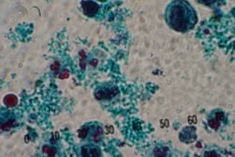 White blood cells in a stool sample in Spider