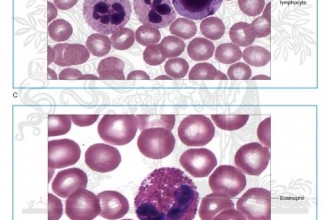 A Large Lymphocyte And An Eosinophi , 6 Pictures Of Two Types Lymphocytes In Cell Category