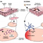 granular layer of normal skin , 6 Diagrams Of Structure And Function Of The Skin In Organ Category