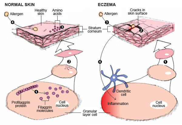 Organ , 6 Diagrams Of Structure And Function Of The Skin : Granular Layer Of Normal Skin