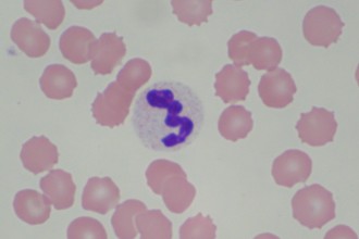Healthy White Blood Cells , 8 White Blood Cells In Urine Pictures In Cell Category