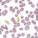 hypogranular platelet atlas , 8 Platelets Science Photo In Cell Category