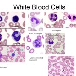 list 5 types of white blood cells , 5 Types Of White Blood Cells Pictures In Cell Category