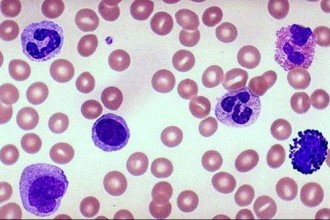 lymphocytes between leukocytes in Cell