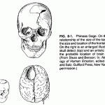 phineas gage accident brain injury images , 5 Phineas Gage Accident Brain Injury Pictures In Brain Category