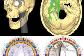 Phineas Gage S Connectome , 5 Phineas Gage Accident Brain Injury Pictures In Brain Category