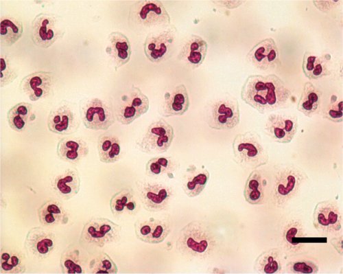 Cell , 8 Neutrophils Pictures : Picture Of Neutrophils