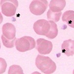 platelets review , 8 Platelets Science Photo In Cell Category