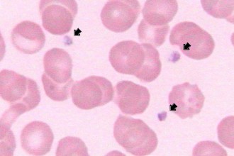 Platelets Review , 8 Platelets Science Photo In Cell Category