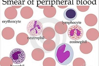 Smear Of Peripheral Blood , 5 Types Of White Blood Cells Pictures In Cell Category