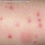 Flea Bite Pictures On Dogs , 5 Amazing Flea Bites On Dogs Pictures In Dog Category