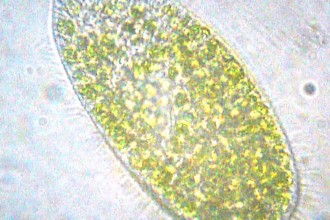 Paramecium Bursaria , 8 Paramecium Images In Cell Category
